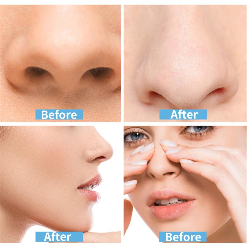 Cosplay Special Nose Shrink Strips Shrink Nose Wings Small Nose Narrow Thin Nose Invisible Beauty Shrinking Nose Wing Stickers