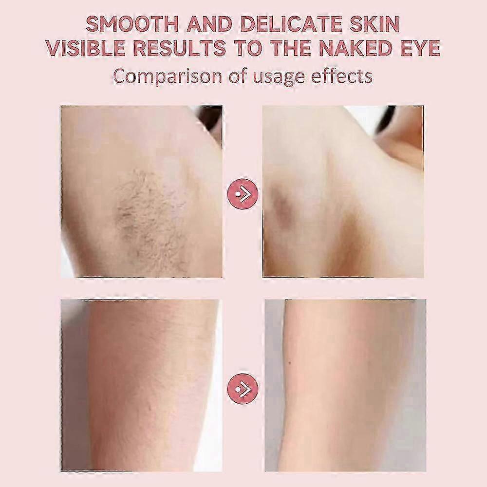 Women’s Rechargeable Painless Facial Hair Epilator Electric Eyebrow Lip Hair Trimmer Gentle Removal