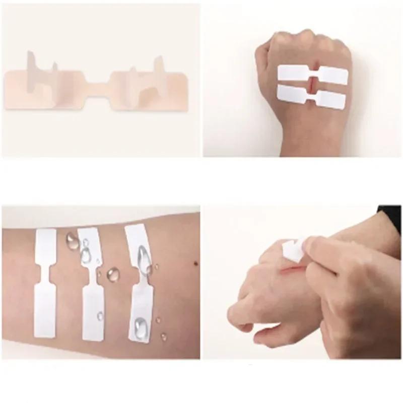 5 ks Dětské proužky Bez stehů Náplasti Venkovní Rychlé Šití rány Zipové pásky Snižují pooperační stav Sportovní doplňky pro přežití