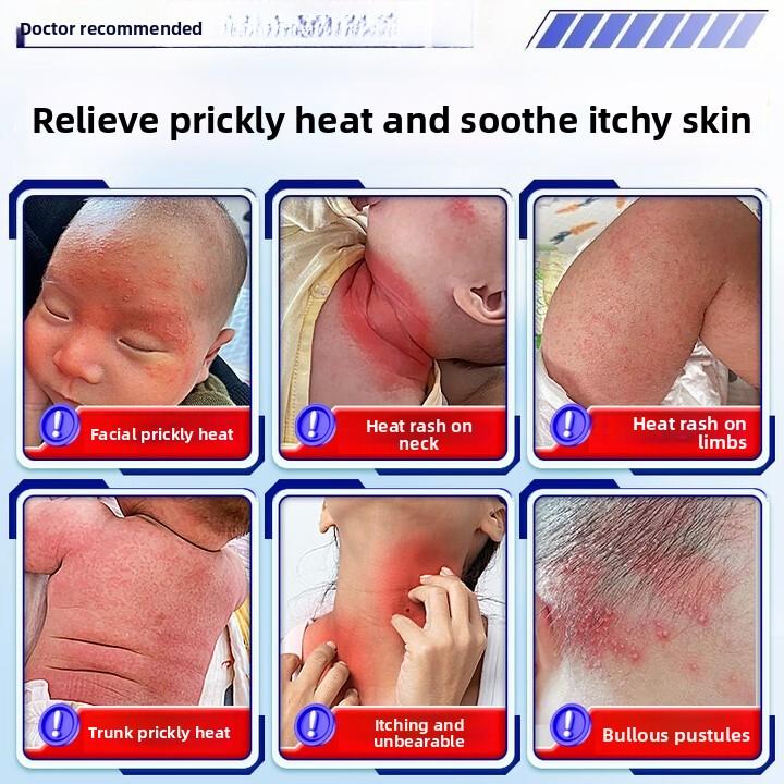 Itch Relief Fast! Anti-Itch Cream for Urticaria & Skin Allergies - Soothes Hives, Rashes On Body, 50g