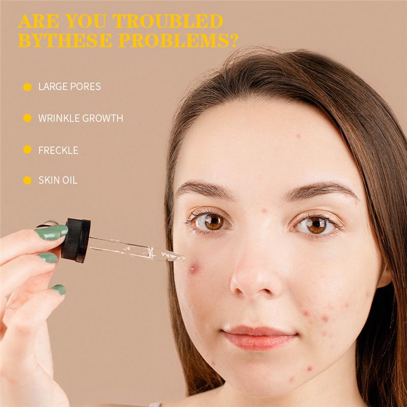 Buy Minch Egg Face Serum Blackhead Remove Essence Pore Minimizer Oil