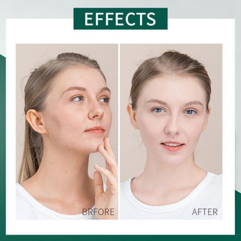 LAIKOU 20Pcs Moisturizing Whitening Night Time Face Mask with Centella Asiatica Extract