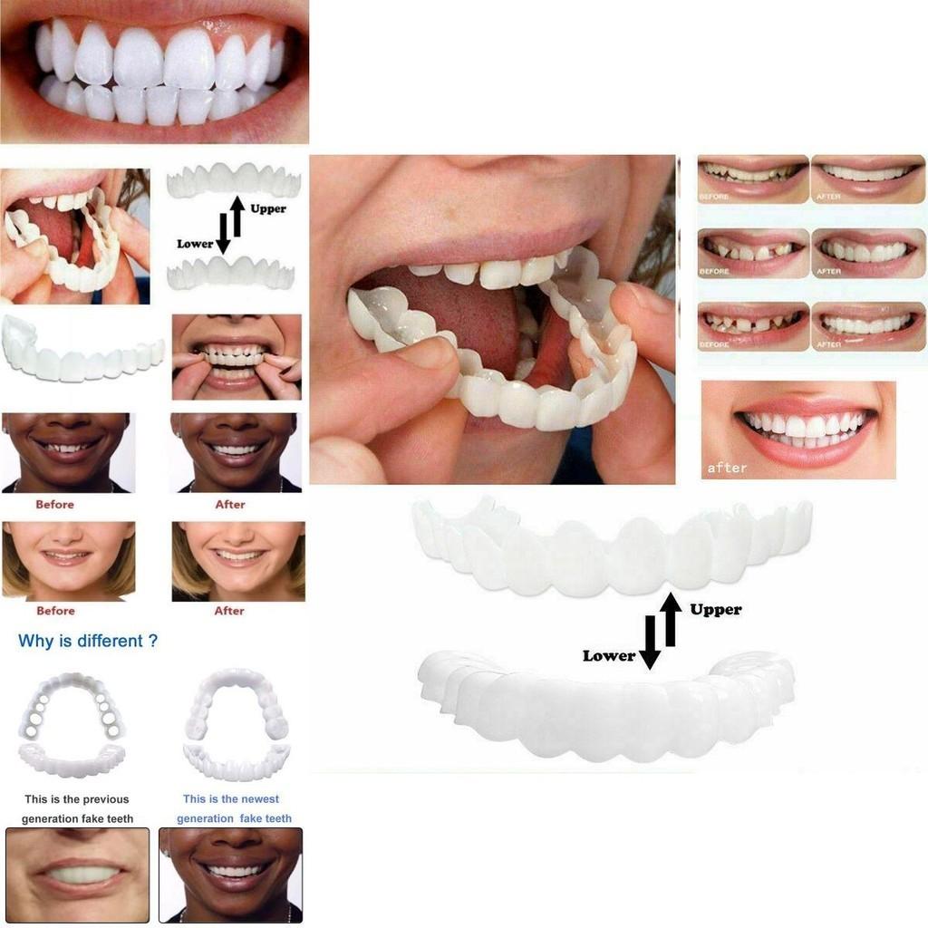 Lower Upper Teeth Dental Veneers Denture Tooth Cover Simulati Set