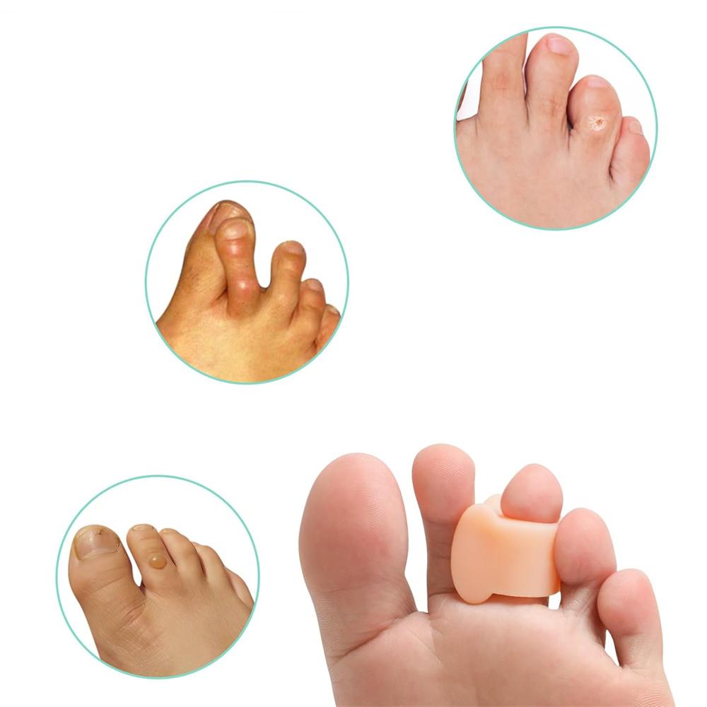 5 Pairs Gel Toe Spacers Big Toe Separators for Bunion Overlapping Toes Hammer Toe Straightener Toe Spreaders for Toe Relaxation