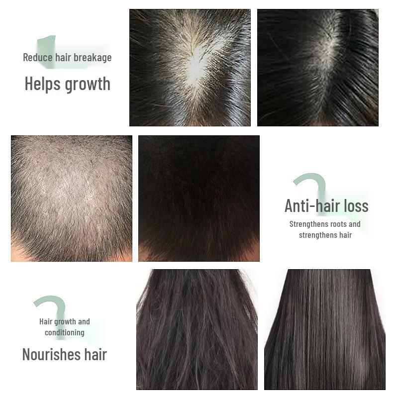 Herbal Hair Growth & Thickening Lotion: Anti-Hair Loss, Follicle Repair, Accelerated Hairline & Hair Density Enhancement.