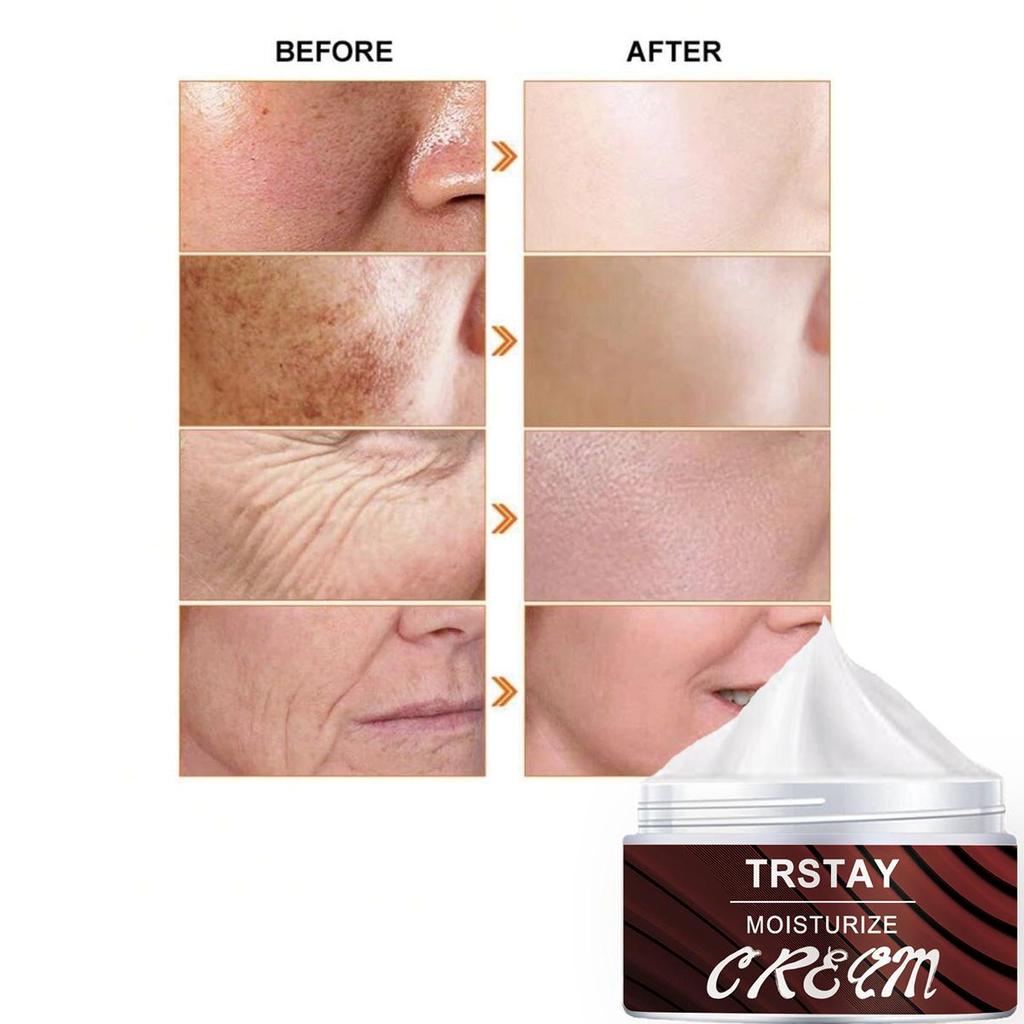 Face Whitening Essence Cream, Brighten and Repair Skin, Even Skin Color, Moisturizing and Moisturizing Cream