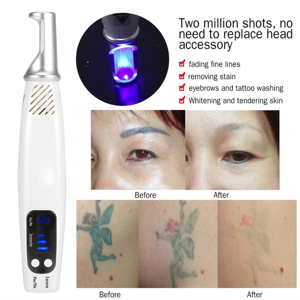 Handheld Picosecond Laser Pen Tattoo Scar Freckle Removal Machine Skin Beauty Device