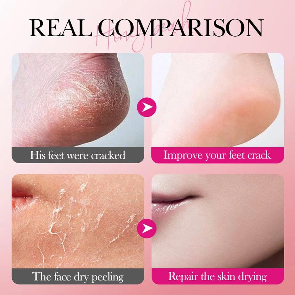 Crema per i piedi ultra-idratante per talloni secchi e screpolati - 40 g - Arricchita con vitamina E e glicerina Senza alcol Fitosqualene - Ammorbidisce e nutre la pelle