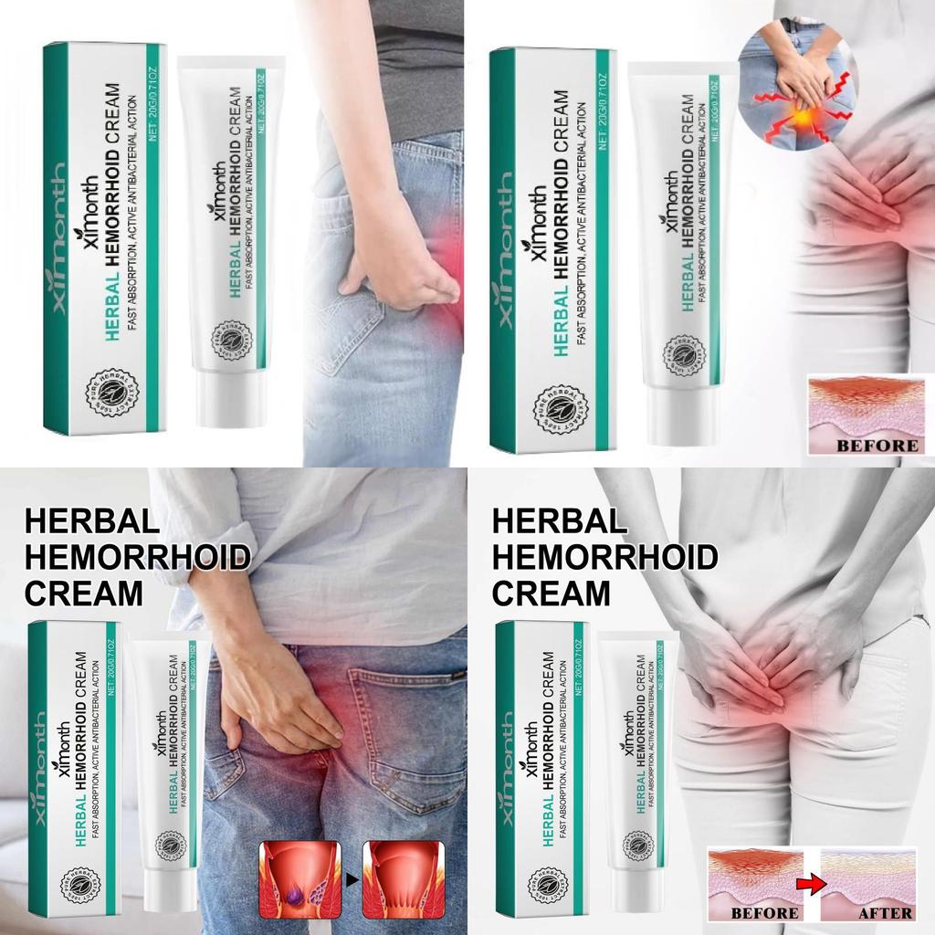 Ximonth Hemorrhoid Cream Soothing Relief For Anal Itching Discomfort And Pain