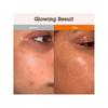 Blithe Niacinamide 5% + Tranexamic Acid 3% Serum 30ml , Dark Spot Corrector - Vitamin B3 Niacinamide For Face, Skin Soothing Cica & Allantoin