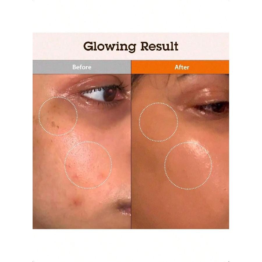 Blithe Niacinamide 5% + Tranexamic Acid 3% Serum 30ml , Dark Spot Corrector - Vitamin B3 Niacinamide For Face, Skin Soothing Cica & Allantoin