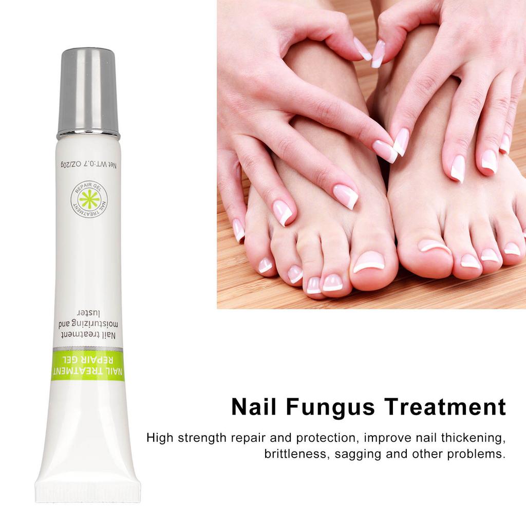 20g Nail Repair Cream Nail Repair Protection Antibacterial Nail Care Gentle Massage Ointment Treatment