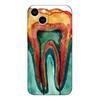 Black Tpu Case For Motorola Moto G52 G42 G60 4G G60S G71 G9 Play Plus Power One 5G Ace Dentist tooth pattern