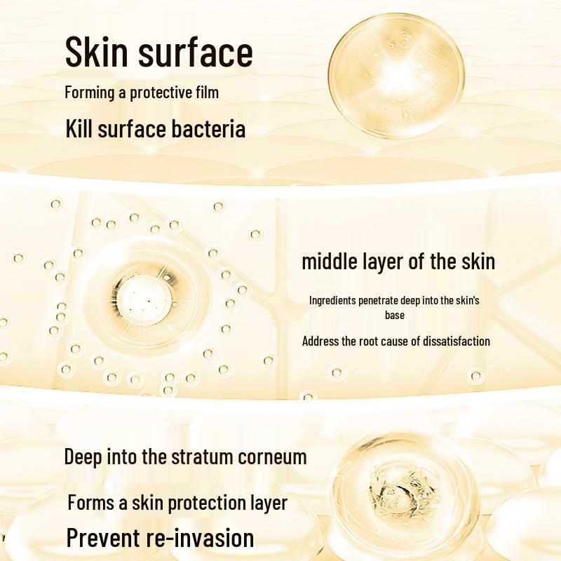 Japanische Athlete's Foot Creme - Antibakteriell, Juckreizlindernd, Schälend, Blasen, Geruchsentferner für Füße & Fußgeruch