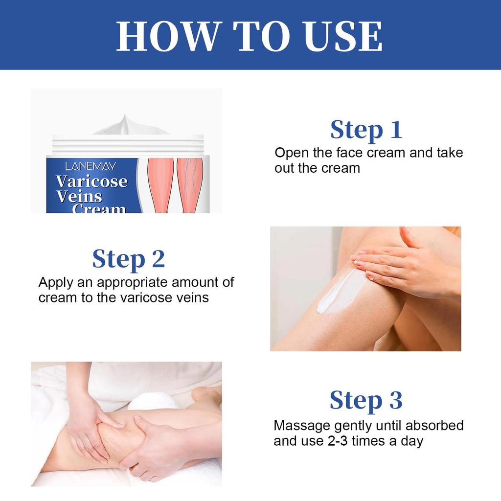 Varicose Veins Cream-Improve Blood Circulation-Relief Swelling And Pain-Minimize Varicose Vein & Spider Vein, 50g