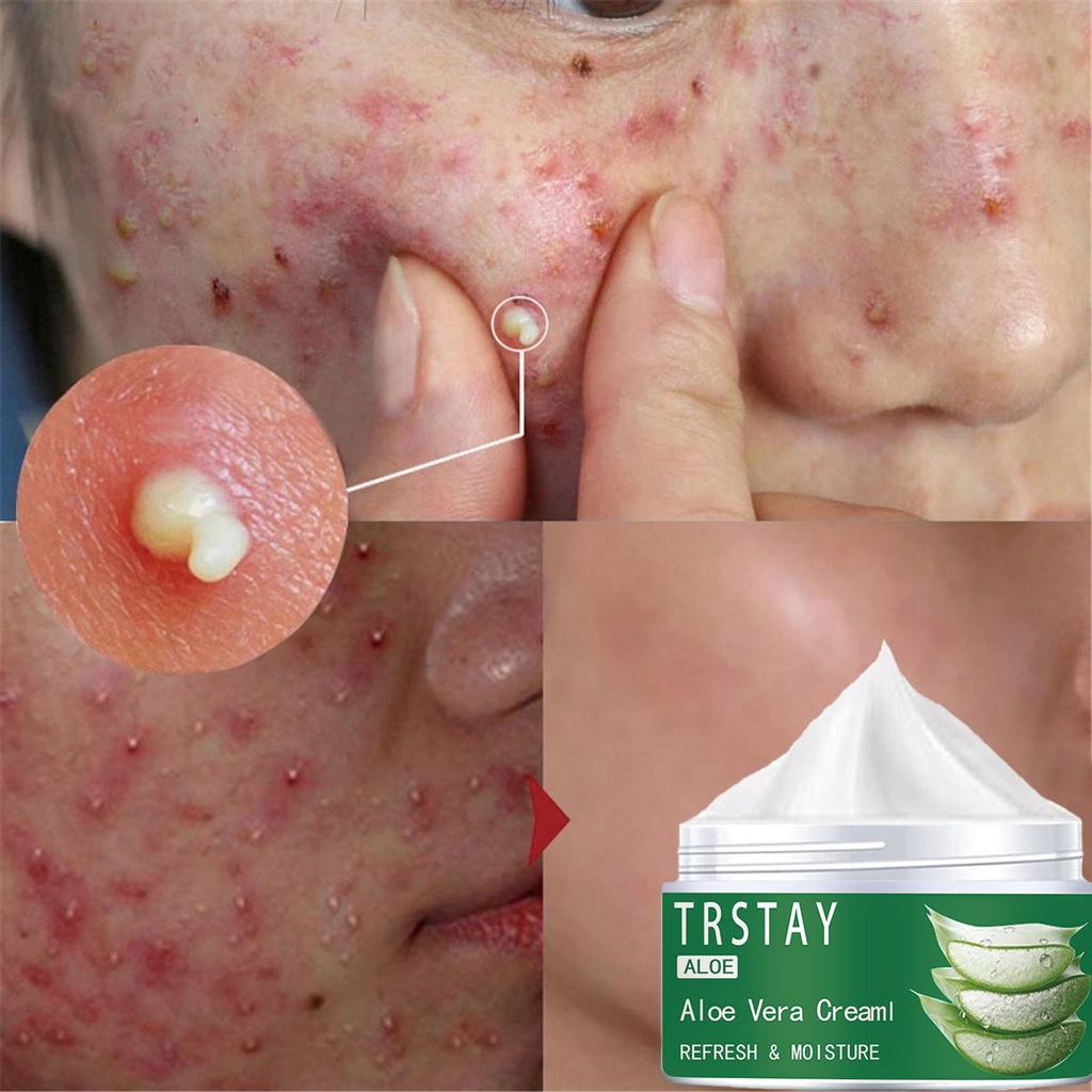 Vysoce hydratační krém z aloe vera, který doplňuje vlhkost, zmírňuje suchost, rozjasňuje tón pleti a zanechává pokožku jemnou a jemnou.