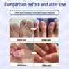 Jingpeitang Onychomycosis Nail Repair Solution