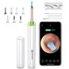 Dispozitive optice – Endoscoape