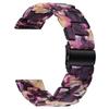 For Nokia Withings Steel HR 40mm Waterproof Resin Acrylic Smart Watch Band Strap 20mm