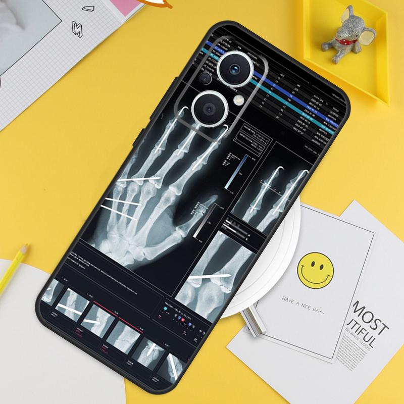 

Radiological Human Organs Skeleton For OPPO Reno 13F 11F 12F 14F 10 11 12 13 14 Pro 8T 7 8 Lite OPPO Find X8 X6 X5 X9 Pro Case OPPO Reno8 T 4G