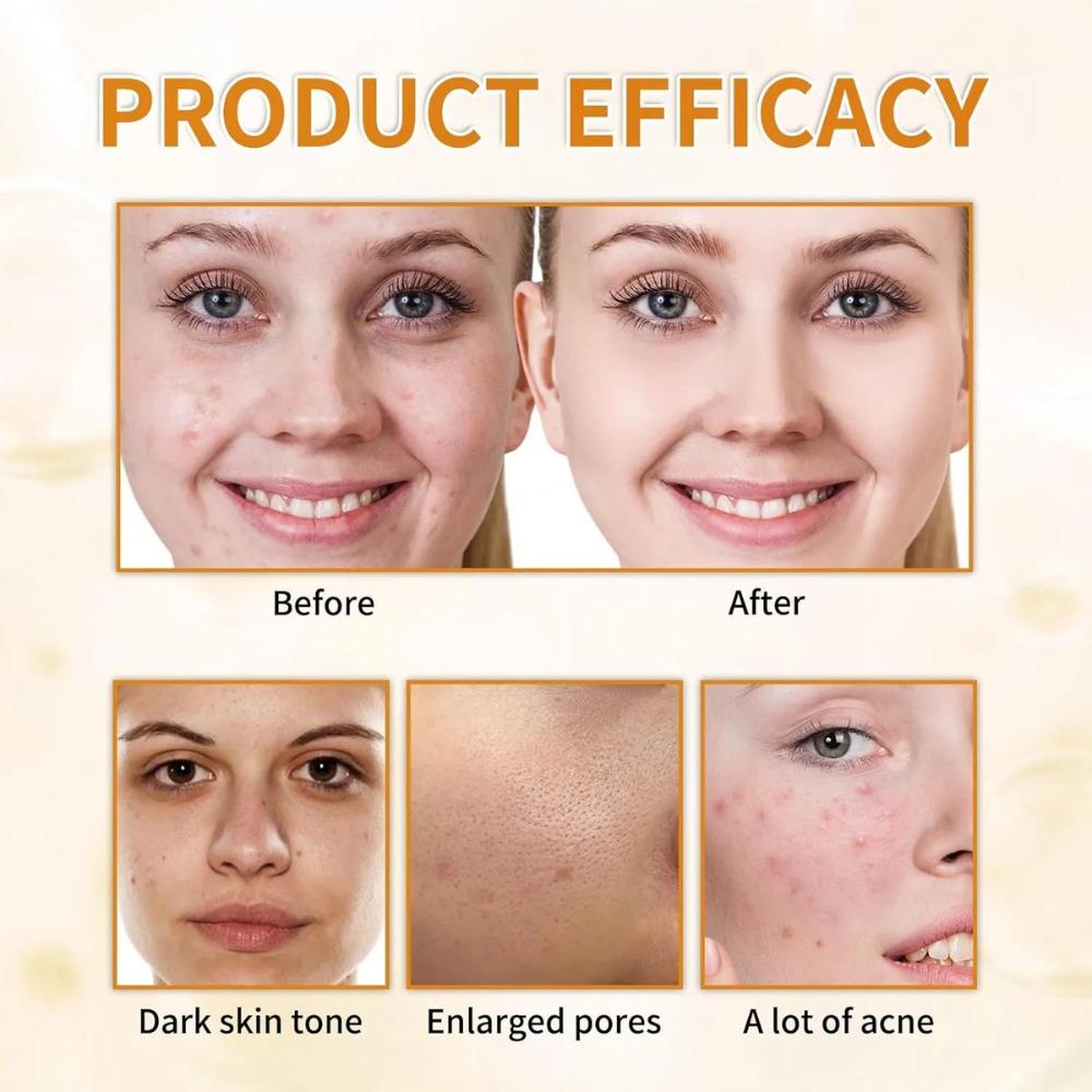 Glycolic Acid Toner 100ml All Skin Type Day/night