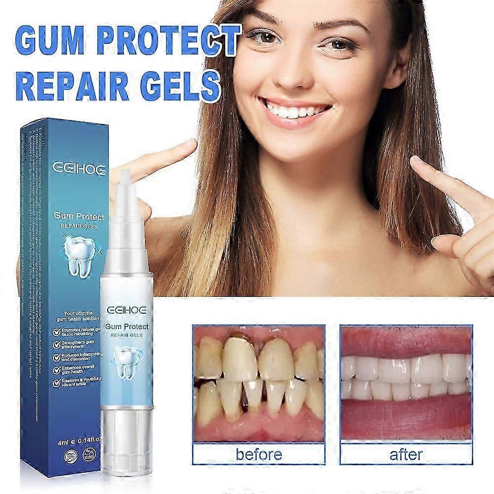 Gum Repair Gel Rebuilding Strengthen Tooth Whitening Anti-Inflammation Oral Care Protect Anti Gingival Stains Recessio Receding Gums Treatment
