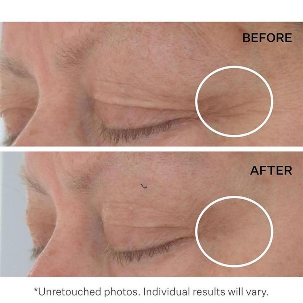 Cremă hidratantă de noapte antirid cu retinol pentru repararea rapidă a ridurilor