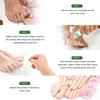 Plaster  Gray Nail Cream  New Bright Potassium Nail Cream  With File