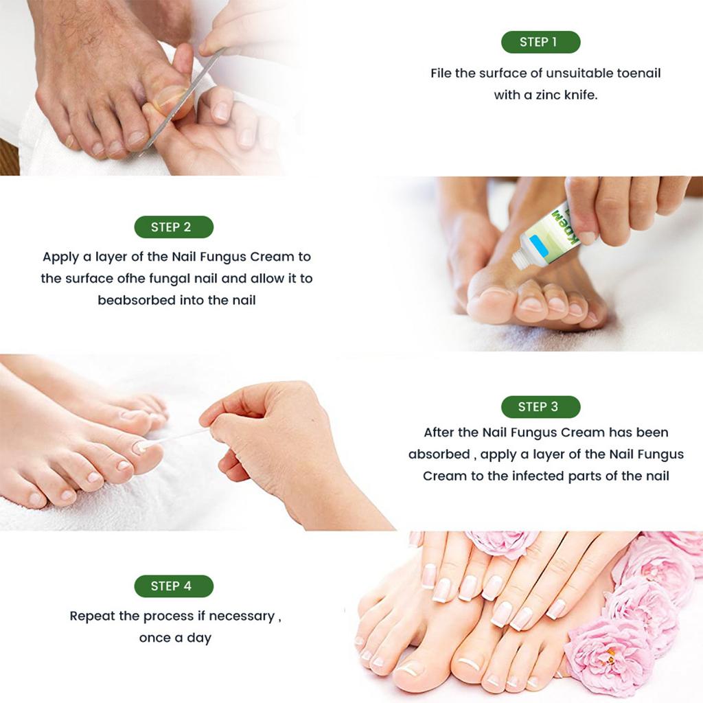 Plaster  Gray Nail Cream  New Bright Potassium Nail Cream  With File