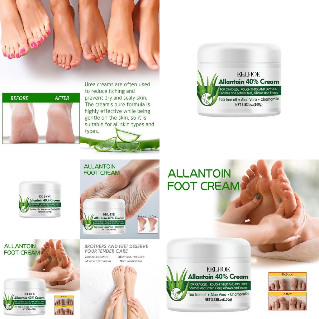 Eelhoe Nourishing Foot Care Cream For Dry Cracked Skin Moisturizing And Hydrating 100g