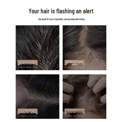 Σαμπουάν και conditioners μαλλιών – Σαμπουάν