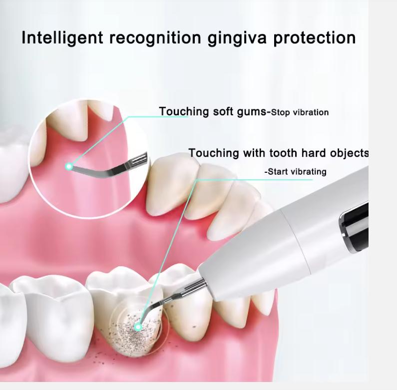 Visueller Zahnsteinentferner Zähne Plaque Schaber Fleckenreinigung Elektrischer Zahnsteinentferner NEU
