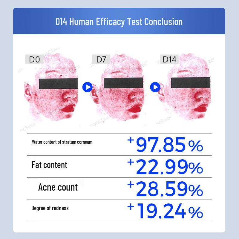 YFUQUAN Anti-Acne Repair Lyophilized Powder & Oligopeptide Serum