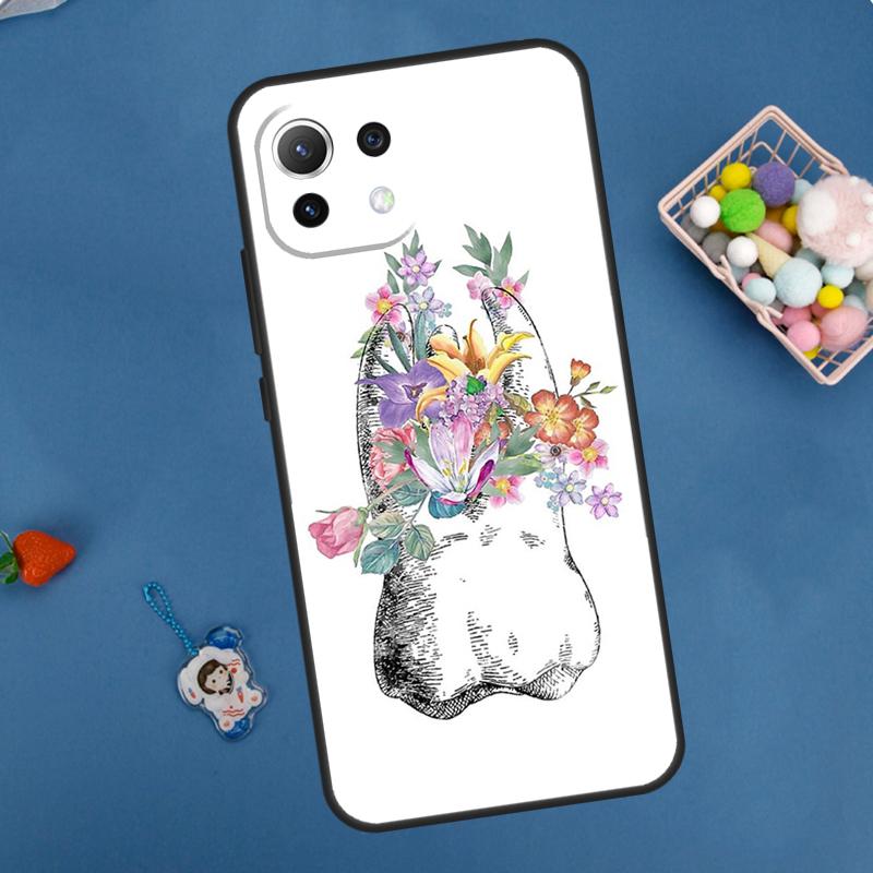 Cute Tooth Dentist Case For Xiaomi 14 13 15 Ultra 11T 12T 13T 14T Pro POCO X7 Pro X3 X5 F5 F6 M6 X6 Pro Cover