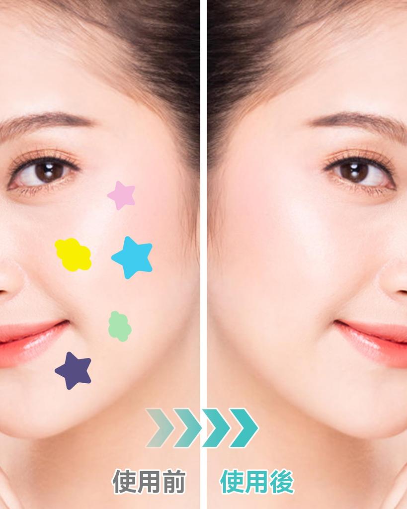 Spot 200 5 for Skin Pimple Skincare Spot Facial Blemish Makeup Large Quantity Large-Capacity Patches, Sheets, Sizes, Care, Patch, Pack, Concealer,