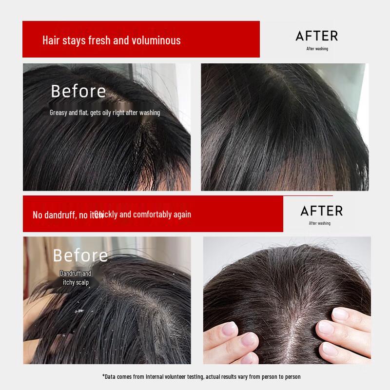 Cailes Bifida Ferment Scalp Care Shampoo