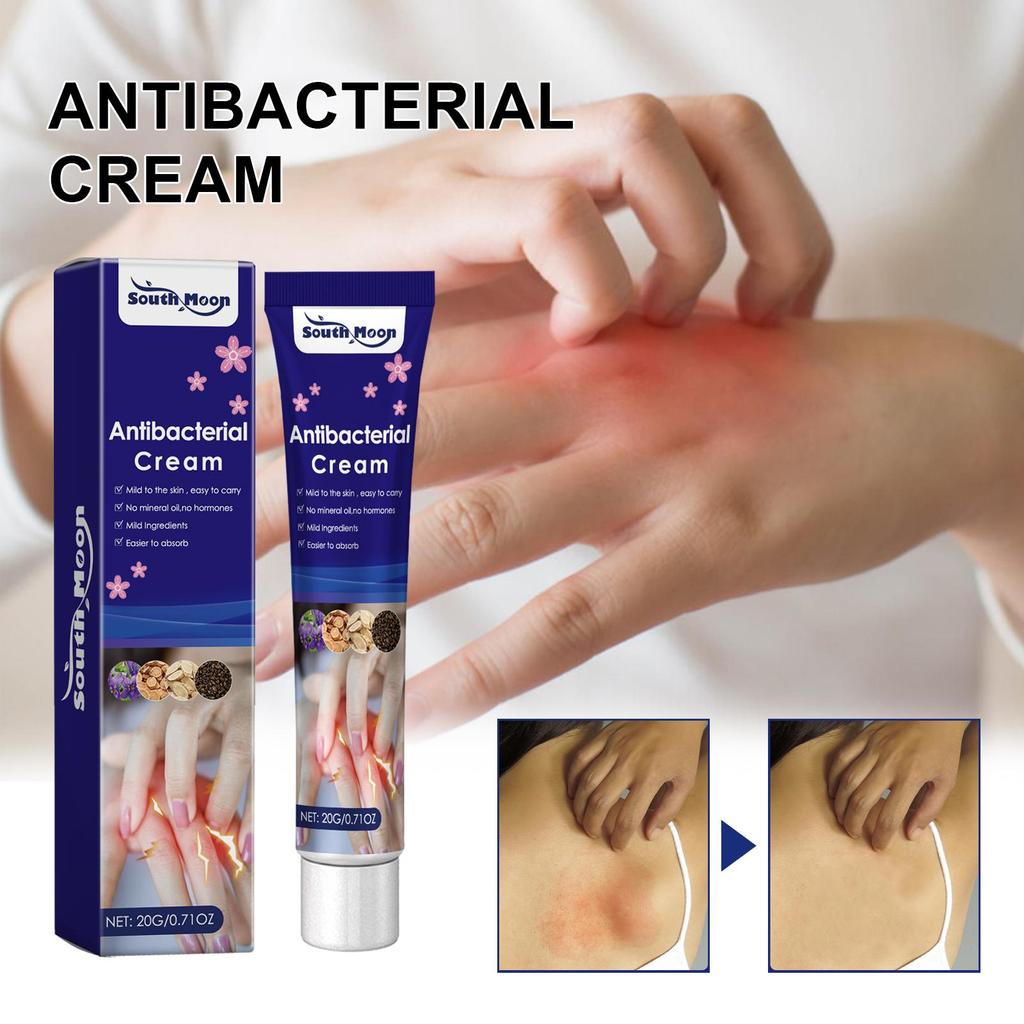 20g Zinfandel Skin Itch Relief Cream Dry, Itchy, Reddened Skin Relief Moisturizing Treatment Ointment
