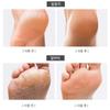Foot Angel Callus-busting Foot Callus Remover Foot Care Moisturizing Serum 1 Ea