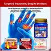 Joint Relief for Fingers: Targets Rheumatism & Swelling