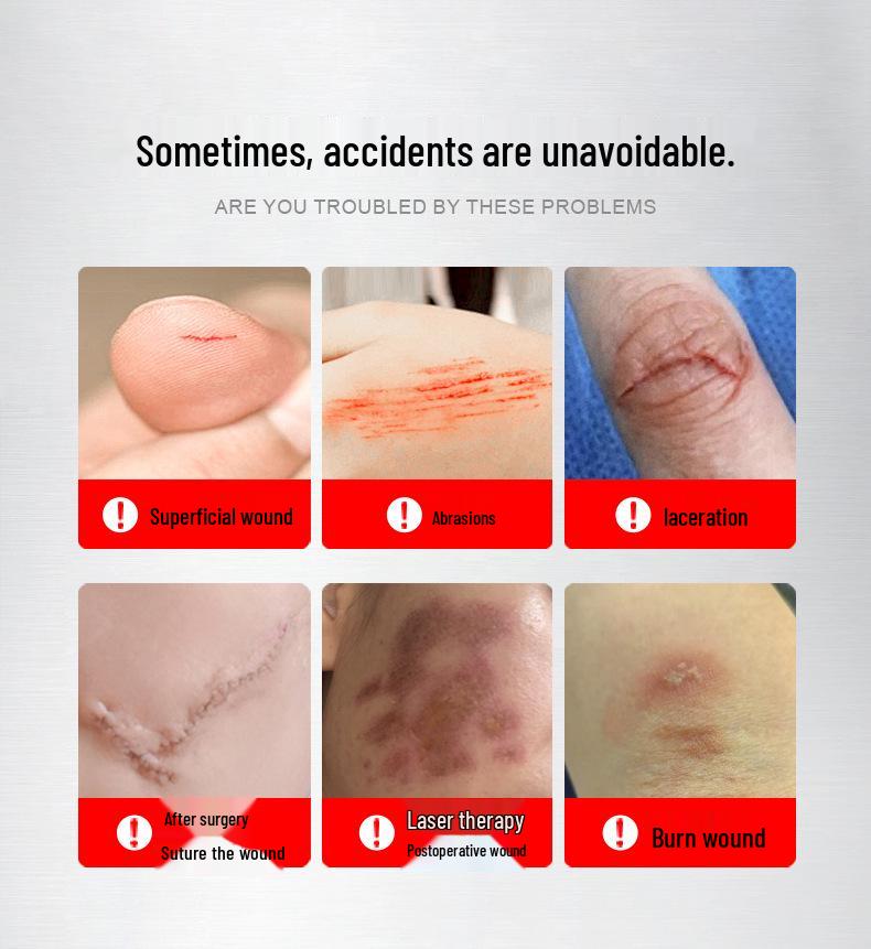 Shuimuwei Medical Collagen Gel for Photorejuvenation and Wound Healing with Fruit Acid Peel.