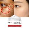 Efficace Crema Sbiancante Lentiggine Rimuovere Melasma Acne Pigmento Spot Melanina Macchie Scure Pigmentazione Gel Idratante Cura Della Pelle