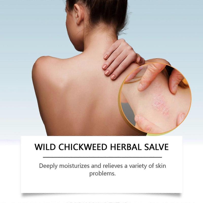1/2/3PCS Chickweed Herbal Salve Skin Redness Relief Anti-itch Cream All Purpose Soothing Skin Balm Skin Care Products