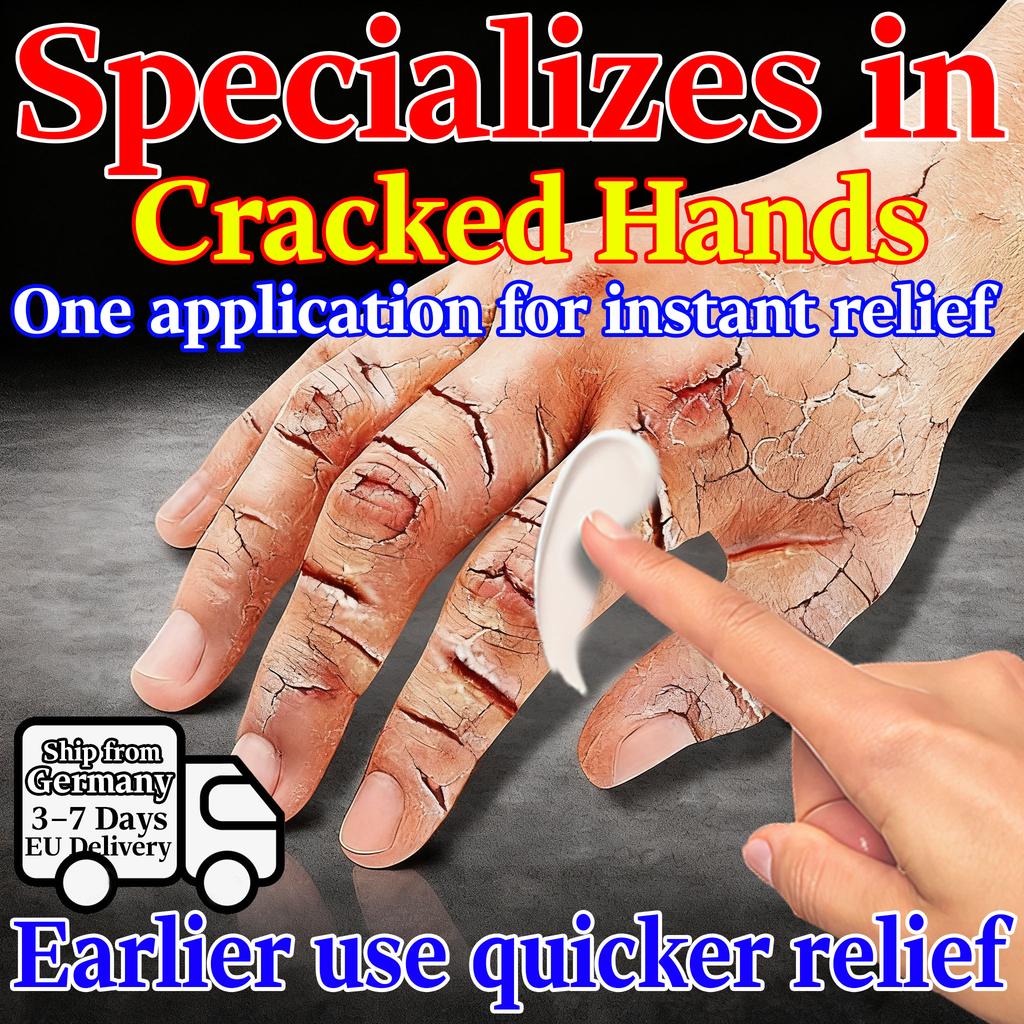 Deep Hydration Ointment for Rough Cracked Hands & Feet - Herbal & Safe