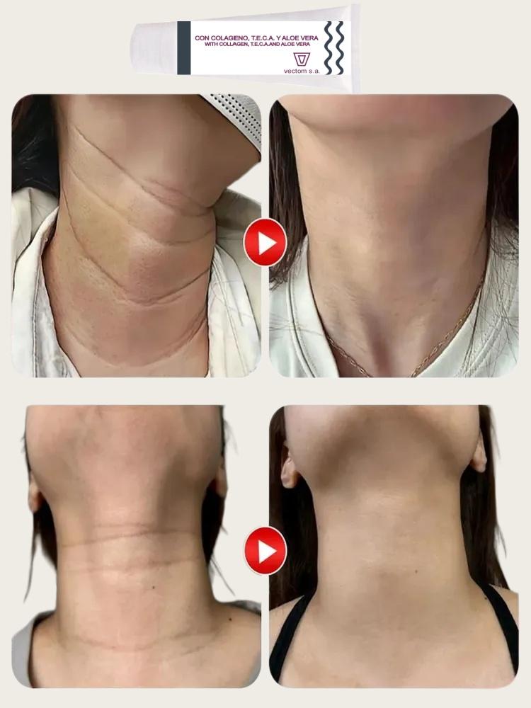 Cream Face and Neck Wrinkle Removing Cream Neck Line Erasing Cream Wrinkle Smooth Skin Cream