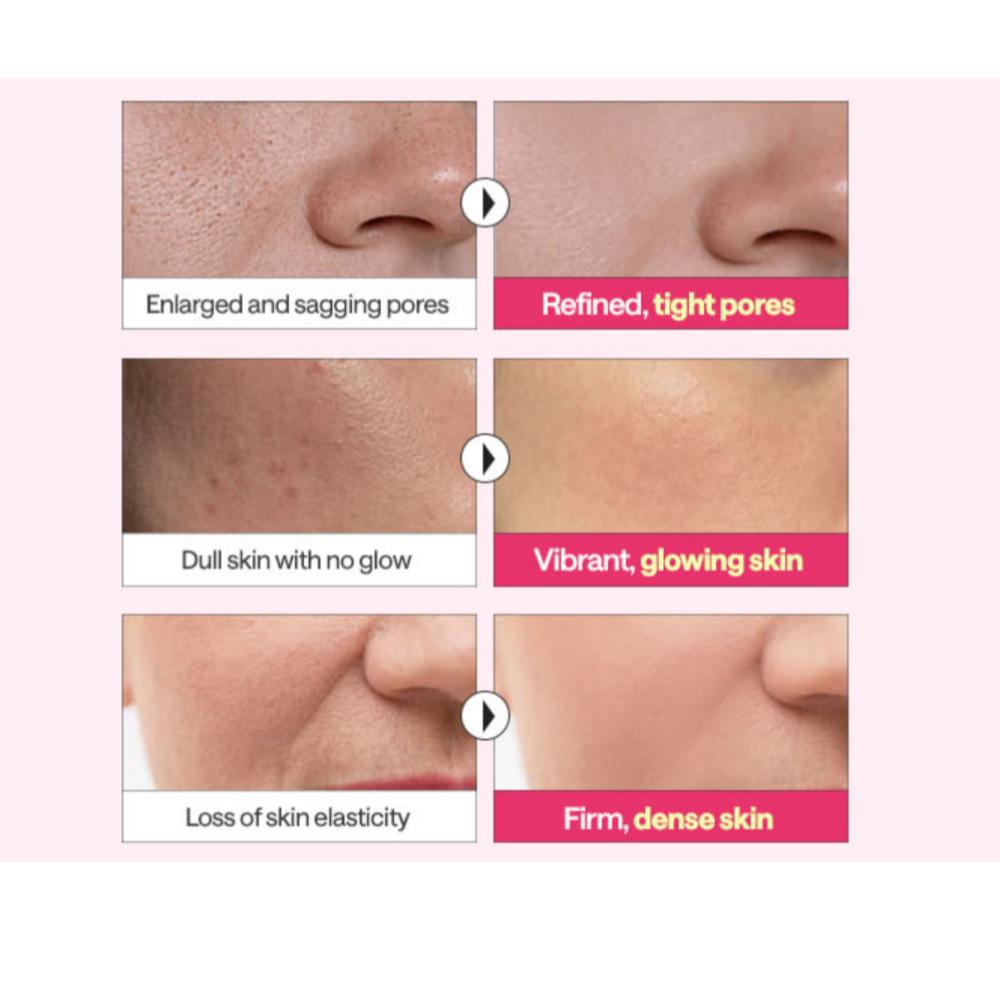 Essensiell Maskeark Vitamin C Kollagen Madecassosid