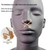 Compact Elastic Self-Adhesive Nose Contouring Patch for Wide Nostrils & Nasal Wing Shaping