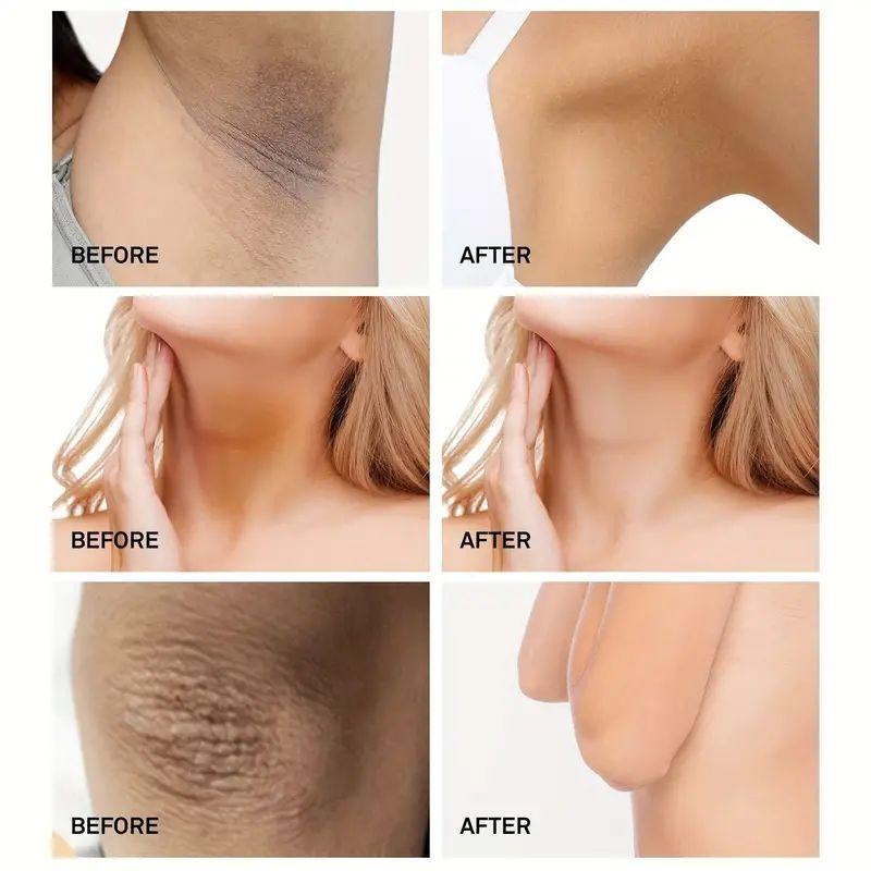 The Skin Cream Moisturizes, Nourishes and Brightens the Skin. Body Lotions and Brightening Creams To Reduce Dull Skin