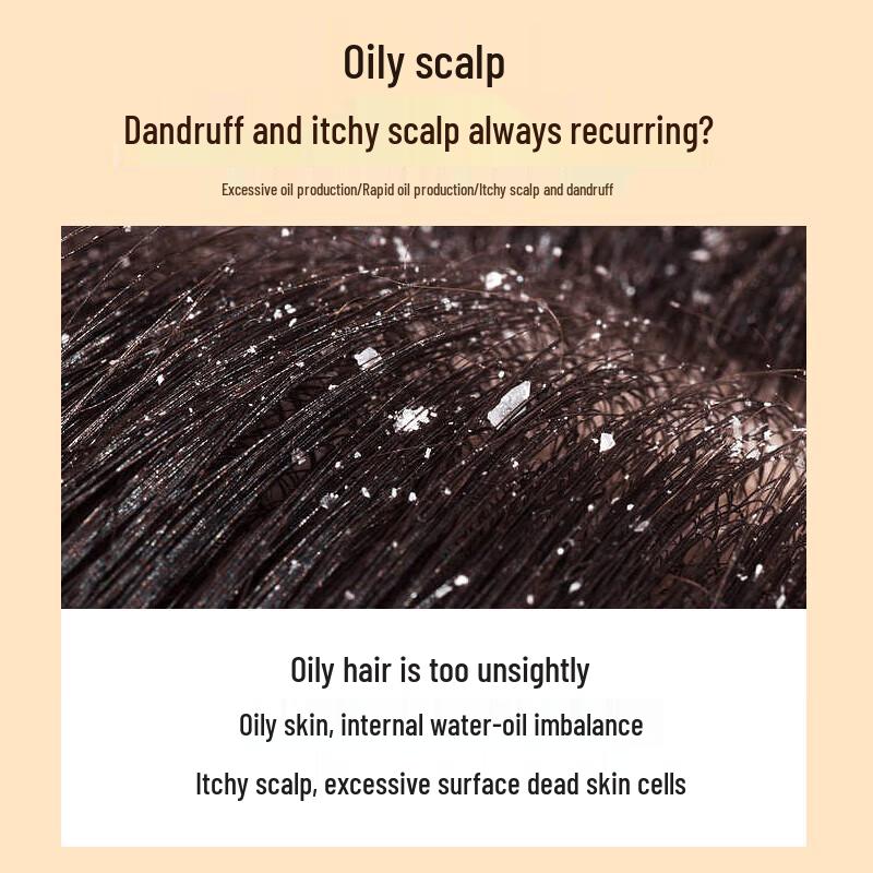 Siyuan Sebum Control Anti-Dandruff Shampoo