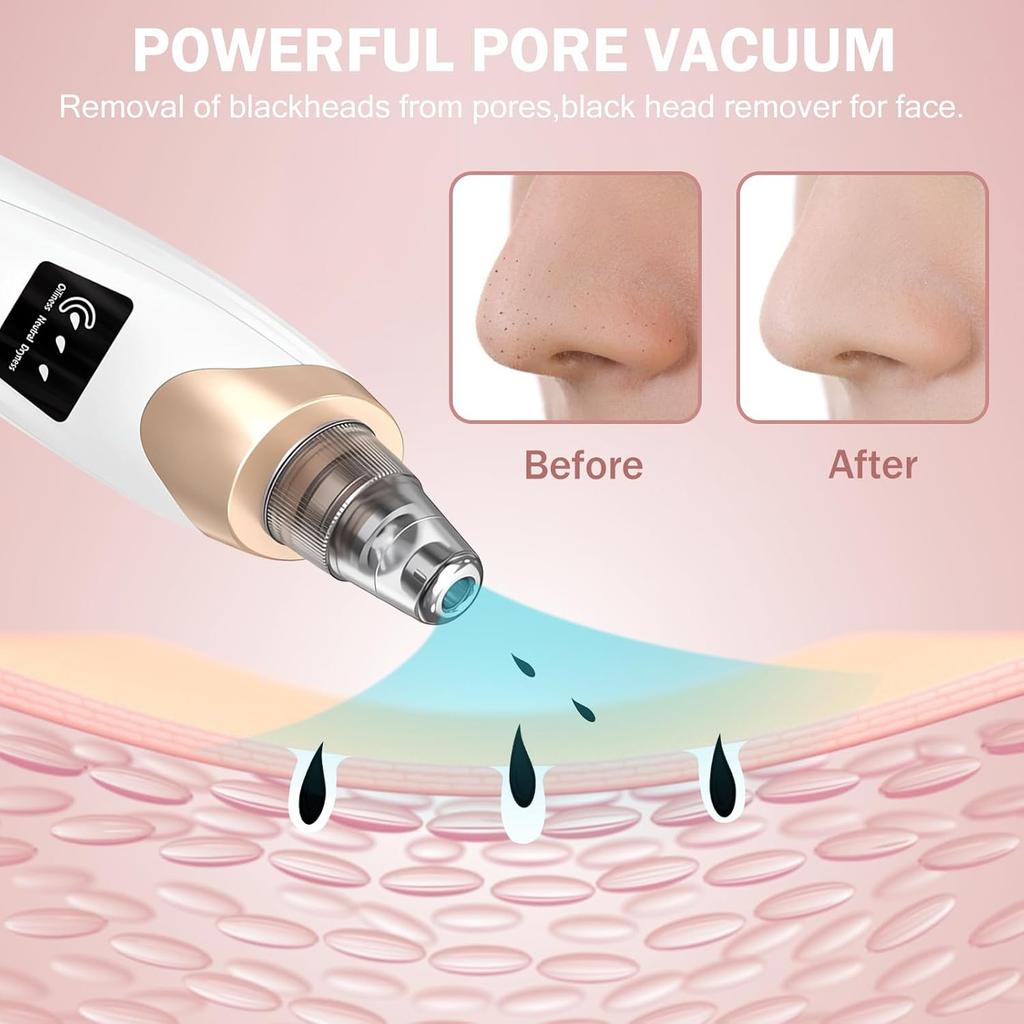 Blackhead Remover Pore Vacuum Kit - 2023 Upgraded Blackhead Extractor Tool with 3 Adjustable Suction Levels, 5 Probes, USB Rechargeable, Suitable for