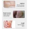 Rechargeable Two Head Callus Remover With Glass Abrasive Heads And Digital Display